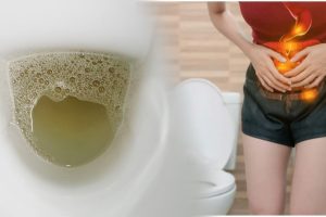 पिसाबमा फिँज आउनु यी रोगका लक्षण हुन सक्छन्, परिक्षण गराउनुहोस्!